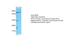 CCDC28A Antibody, Novus Biologicals 100 &mu;L | Buy Online | Novus Biologicals | Fisher Scientific